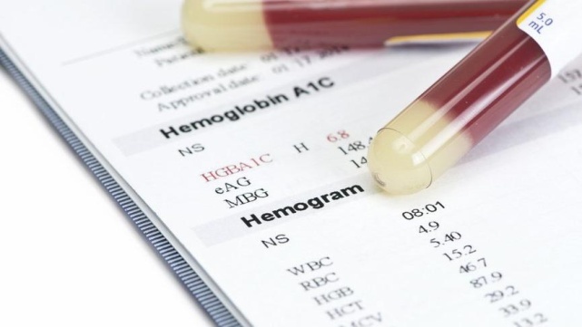 hemogram testi